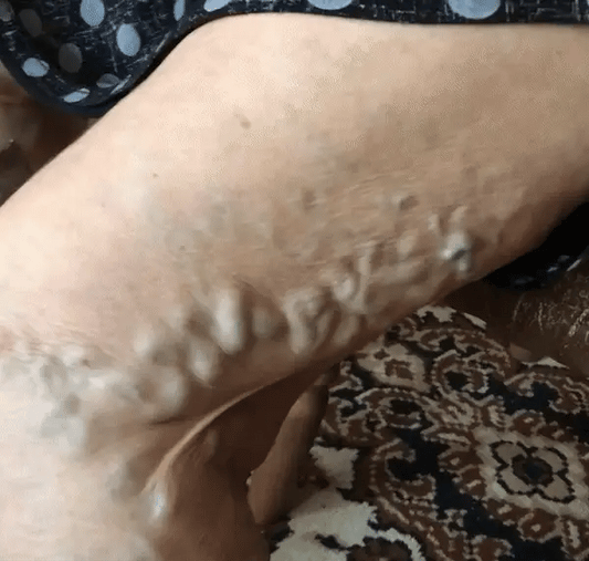 Anti-Kŕčové™ Náplaste